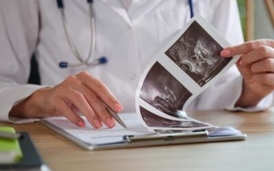 CSÖKKENT A DAGANATOS HALÁLOZÁSOK SZÁMA